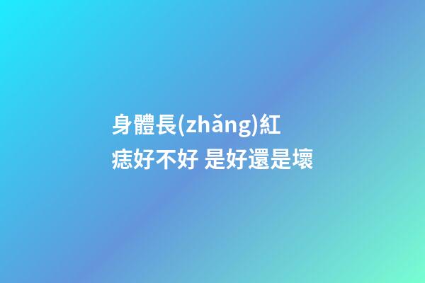 身體長(zhǎng)紅痣好不好 是好還是壞
